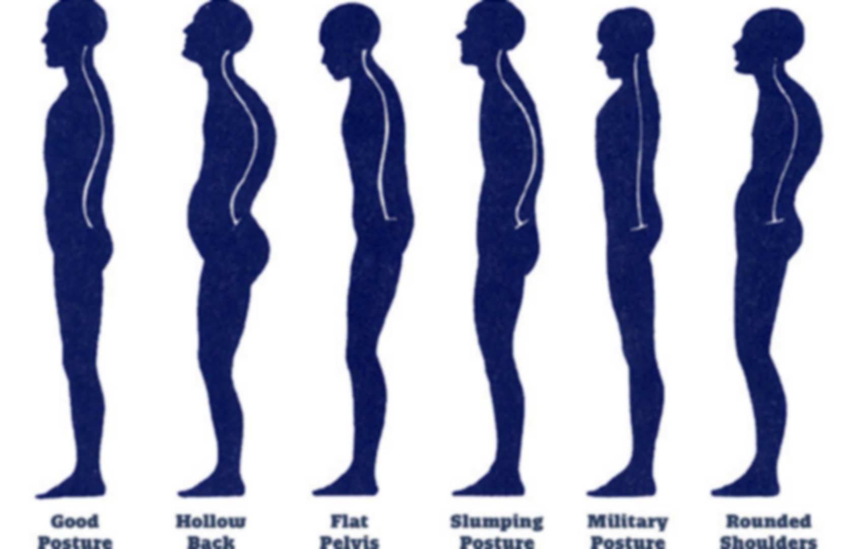 How To Fix Flared Ribs - Posture Direct