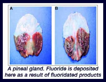 http://www.pearltrees.com/s/pic/or/pineal-gland-fluoride-52681718